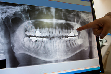 Capehart Family Dentistry | Restorative Dentistry, Preventative Dentistry and Cosmetic Dentistry